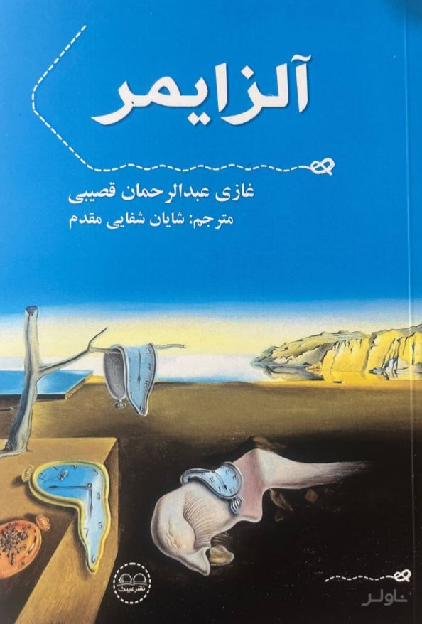 آلزایمر